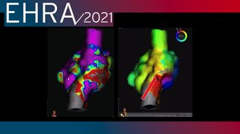 EHRA 2021 : rôle de l’imagerie dans l’ablation des cardiopathies congénitales