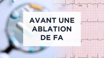 AOD avant une procédure d’ablation de FA