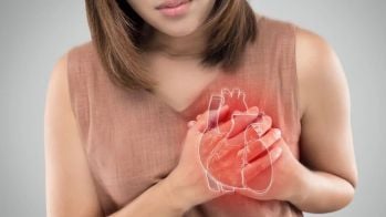 Recommandations de l'Académie de médecine pour réduire l'inégalité de prise en charge de l'infarctus chez les femmes