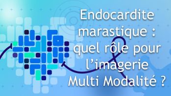 Endocardite marastique : quel rôle pour l’Imagerie Multi Modalité ?