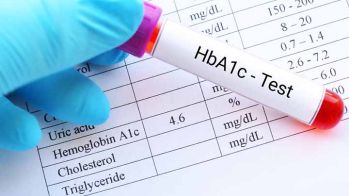 Diabète et fibrillation atriale : le risque thrombo-embolique lié au niveau d'HbA1c