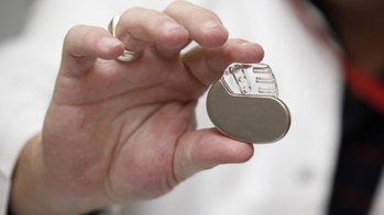 Allergie de contact à un implant cardiaque: une situation rare mais importante