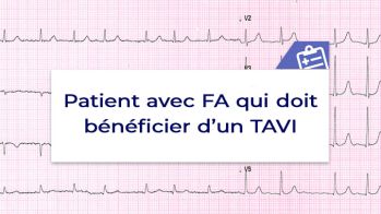 Le patient avec FA qui doit bénéficier d’un TAVI