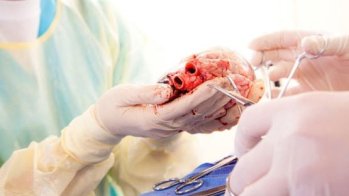 Le prélèvement de cœur sur une personne décédée d'arrêt cardiaque désormais autorisé
