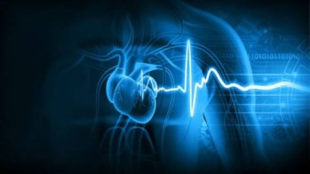 Un grand nombre de morts subites cardiaques liées à des maladies cardiaques non diagnostiquées