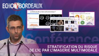 Stratification du risque de l’insuffisance cardiaque par l’imagerie multimodale