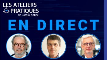 Atelier pratique : Prévention secondaire post-SCA, objectif 0,55 - En direct