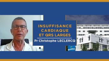 Insuffisance cardiaque et QRS larges