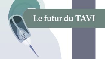 Le futur du TAVI