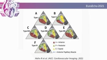 Pourquoi est-ce important et comment évaluer l’anatomie et l’étiologie de l’insuffisance tricuspide ? 