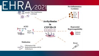 EHRA 2021 : Covid-19 chez les enfants et rôle de l’imagerie cardiaque