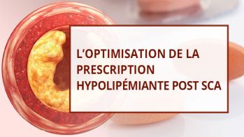Optimisation de la prescription hypolipémiante post SCA : une stratégie "à la française"
