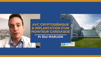 AVC cryptogénique, chez quels patients discuter de l’implantation d’un moniteur cardiaque implantable ?
