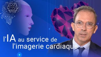 L’IA au service de l’imagerie cardiaque
