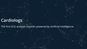 Le cloud et l’intelligence artificielle au service de l’analyse rapide des ECG ambulatoires