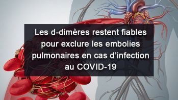 Les d-dimères restent fiables pour exclure les embolies pulmonaires en cas d’infection au COVID-19.