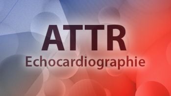 Quels sont les paramètres échocardiographiques au cours du suivi du traitement d’une amylose cardiaque à transthyrétine ?