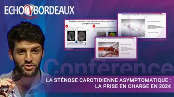La sténose carotidienne asymptomatique : la prise en charge en 2024