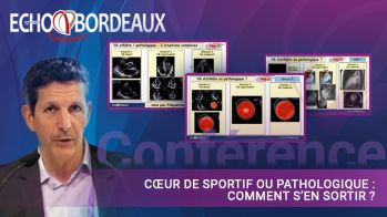 Cœur de sportif ou pathologique : comment s’en sortir ?