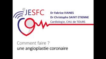 Interventionnel : comment réaliser une angioplastie coronaire