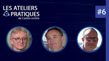 Détection de la fibrillation atriale : qui, quoi, comment ?
