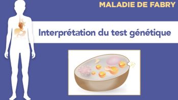 Maladie de Fabry : difficultés d'interprétation du test génétique