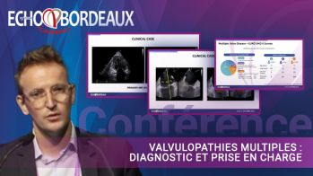Valvulopathies multiples : diagnostic et prise en charge
