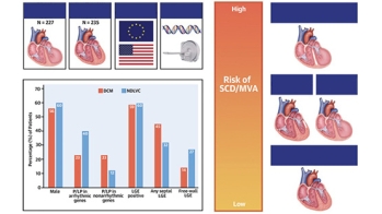 Cardiomyopathie dilatée, quel bilan réaliser ?