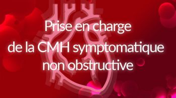 La prise en charge de la CMH symptomatique non obstructive