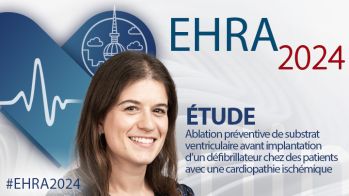 Étude ASTRO : effet de l’isolation de l’auricule par cryothérapie dans les récidives de FA