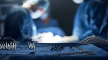 Fibrillation atriale: la ligature de l'appendice auriculaire gauche sans bénéfice sur les récidives