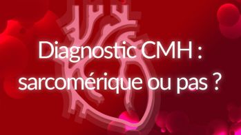 Diagnostic de la cardiomyopathie hypertrophique : sarcomérique ou pas ?