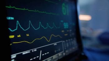 L'expérimentation d'IA pour l'interprétation des ECG devrait débuter à l'été 2025