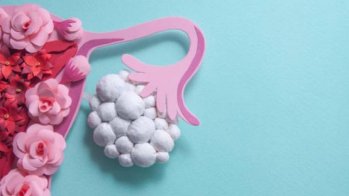 Le SMOP (ex SOPK) avec hyperandrogénie associé à un risque fortement accru d'hypertension et de dyslipidémie