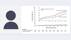 Quelle imagerie coronaire dans l’angor chronique stable : scanner ou angiographie ?