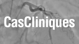 Imagerie cardiaque : cas clinique "Une coronarographie surprenante"
