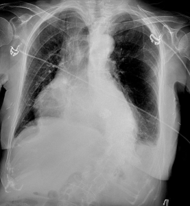 Le-coeur-a-ses-raisons-que-la-jugulaire-ne-connaît-point-figure3.jpg