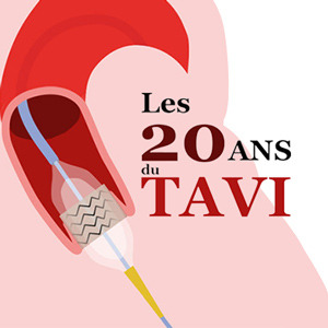 20 ans du tavi