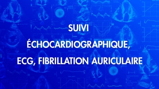 Amylose cardiaque : suivi échocardiographique, ECG, fibrillation auriculaire