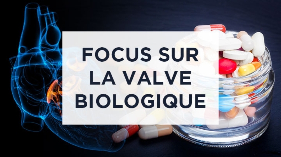 AOD et valve biologique