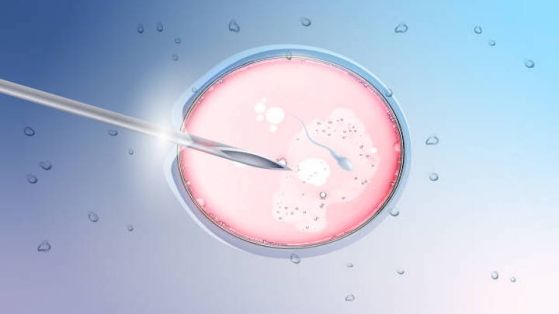 Le risque de cardiopathie congénitale majeure est augmenté chez les enfants issus de FIV ou d'Icsi