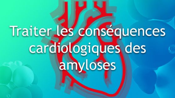 Traiter les conséquences cardiologiques des amyloses