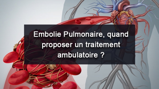 Embolie pulmonaire – Quand proposer un traitement ambulatoire ?