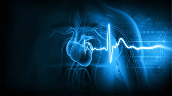La mortalité à 10 ans après ablation par cathéter de la tachycardie ventriculaire proche de 40% chez les patients tout-venant