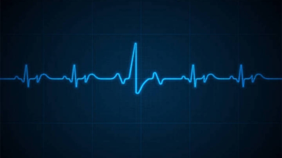 Intérêt d'un ECG de dépistage à un âge moyen pour identifier des personnes à risque cardiovasculaire augmenté