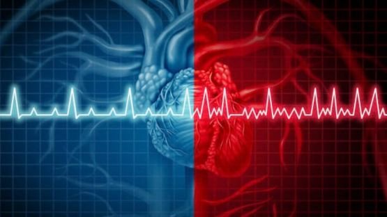 Meilleure efficacité à long terme de l'ablation de la fibrillation atriale par électroporation