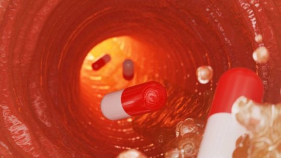 Après un épisode hémorragique sous AOD, mieux vaut resterpasser sous apixaban