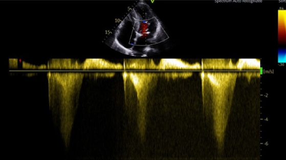 Le SAM, c’est celui qui ne boit pas !