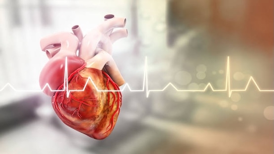 L'ablation par cathéter de la fibrillation atriale a un intérêt après 80 ans, chez des patients bien sélectionnés