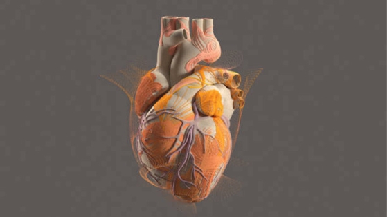 La calcification extracoronaire associée à un risque accru d'insuffisance cardiaque à fraction d'éjection préservée